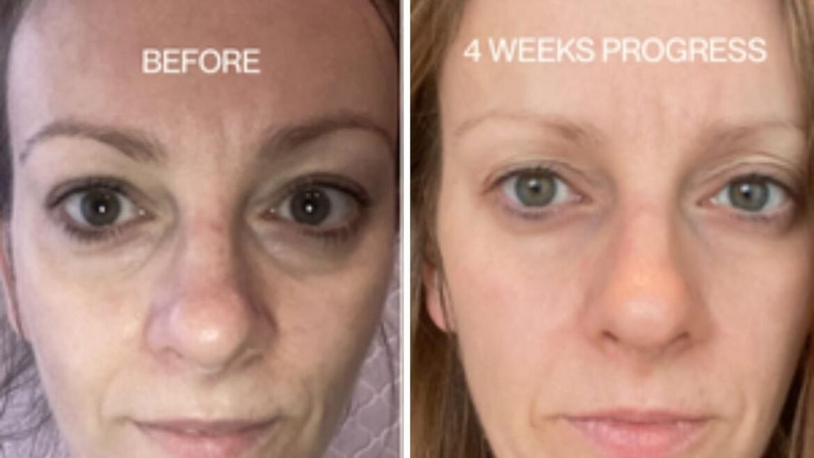 Dapatkan diskon 35 persen hingga $100 untuk Serum Transformasi Kulit Menopause pada Black Friday ini: Kecantikan yang Dapat Dimakan