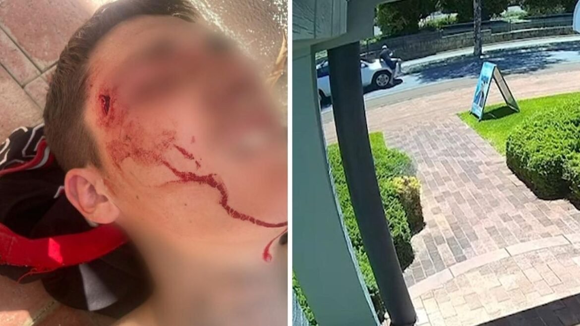 Remaja tertabrak mobil di sisi jalan yang salah di Mandurah, Washington