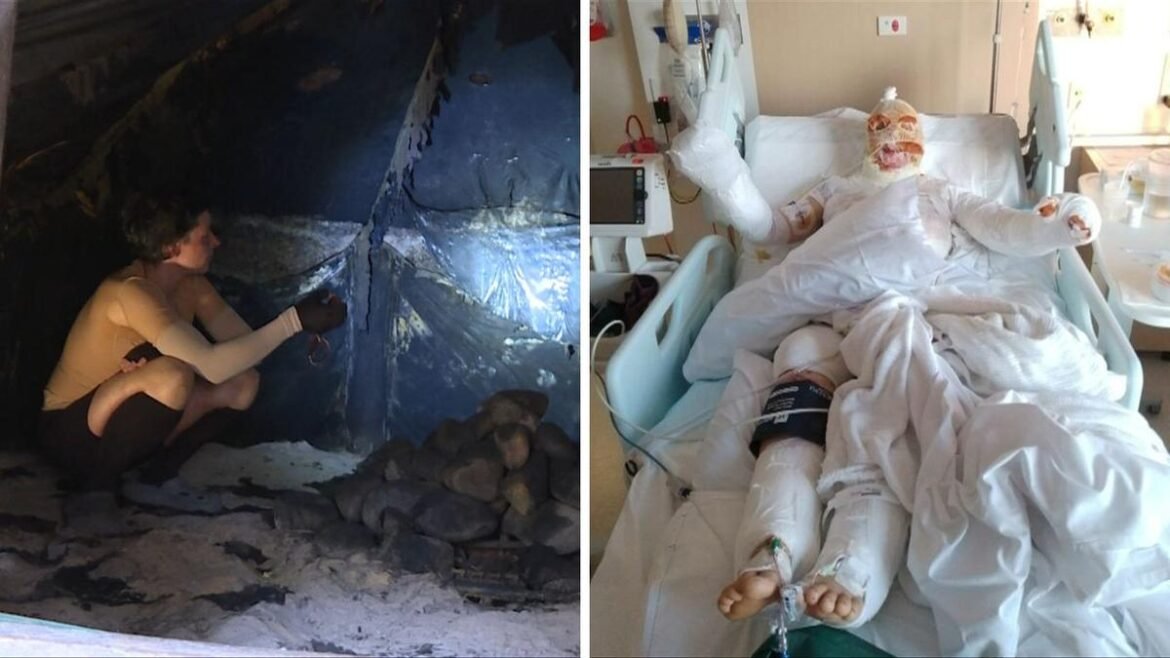 Wanita Albany terluka parah dalam ledakan sauna bawah tanah buatannya